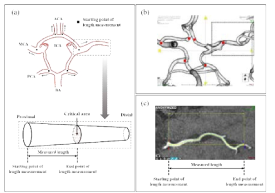(a) 혈류분배율 결정을 위한 뇌혈관 길이측정법의 도식도. (b, c) 뇌혈관 길이측정 과정