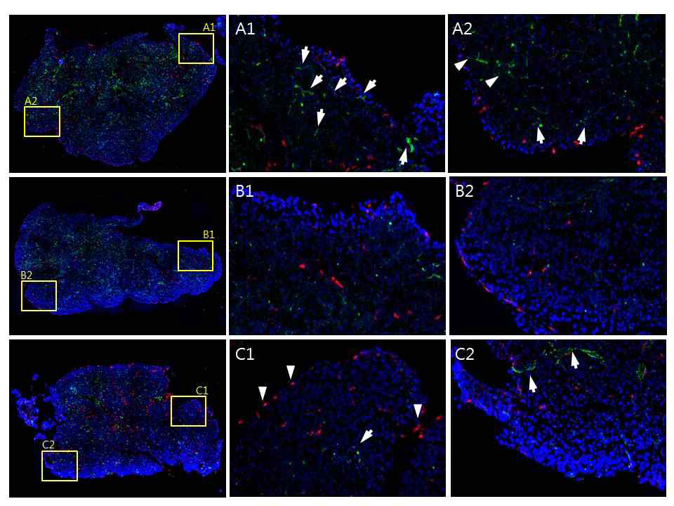 UPPER LOW: 건성안자극 전, MIDDLE LOW: 건성안자극 3일, LOWER LOW: 건성안자극 1주 째 confocal microscopy stitched image for total area. 혈관 (초록색, CD31, white arrow)은 점차 사라지고 임파관 (붉은색, LYVE-1, arrowhead)는 증가하는 양상을 보인다