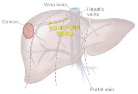 다목적 모듈형 마이크로로봇 제어기술을 활용한 유선 자기 카테터의 간암 치료 예시