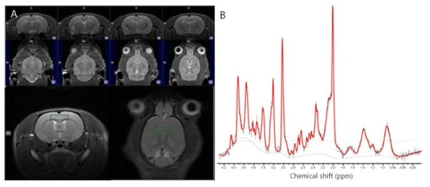 (A) 단일체적 MR 스펙트럼을 획득할 관심체적 (VOI)의 위치를 설정하기 위해 촬영한 axial, coronal T2 강조 영상. (B) 다중체적 생체내 MRS로 획득한 전전두엽 관심체적의 스펙트럼. LCModel linear fitting 스펙트럼 (적색선)