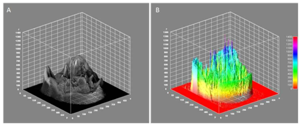 (A) human brain에 대한 gray scale 형식으로 3차원 렌더링. (B) 미세 출혈 부위 시각화 표현을 위해 multi plot 재구성 알고리즘 사용 및 출혈부분 blue plot으로 시각화
