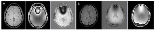 (A) 첫 번째 파라미터 최적화위한 reference image, magnitude image와 phase image를 획득함. (B) 두 번째 파라미터 최적화한 뒤 reference image, magnitude image와 phase image를 확립함