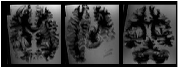 Brain 모사 팬텀의 고해상도 MRI 대표적 슬라이스 형태. 융합 MR 기준 좌표계 수립을 위해 파라미터 최적화를 수행함