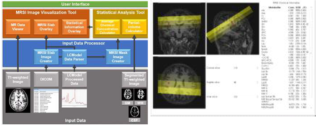 MRS image 측정 및 분석을 위한 in-house 프로그램. 프로그램의 구조 (좌). 프로그램 내에서 MRS slab image, 화학적 농도 값, 특정 voxel의 FWHM, signal to noise ratio 정보 제공 화면 (우). (Lee et al., 2016)