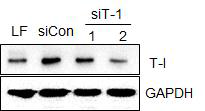 표적 단백질 T-I의 발현 조절하는 siRNA 확보