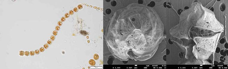 2018년 적조 발생종 Alexandrium affine 광학 및 전자현미경 사진