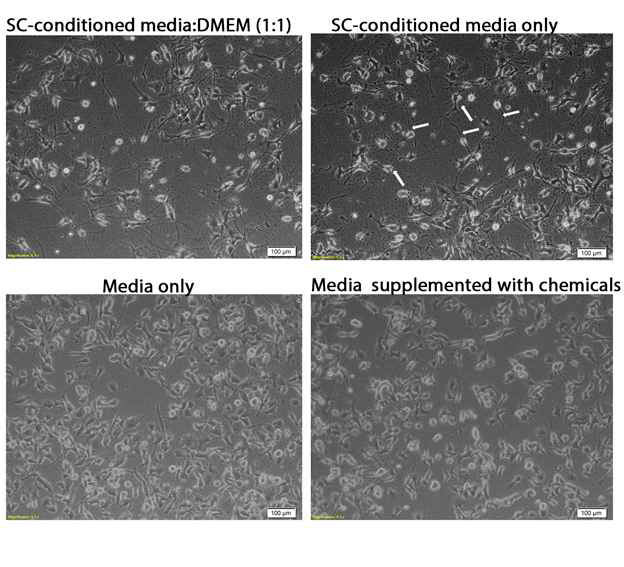 섬유아세포에서 분화된 유사슈반세포이 활성 검증. Schwann cell (SC) culture media를 넣어 준 겨우 neurite발생이 현저히 증가해 있음을 확인할 수 있음 (화살표)