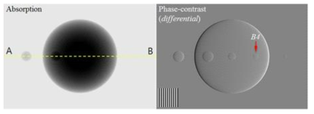 영상재구성 알고리즘을 통해 획득된 흡수차 영상(absorption, 左)과 위상대조 영상(differential phase-contrast, 右)