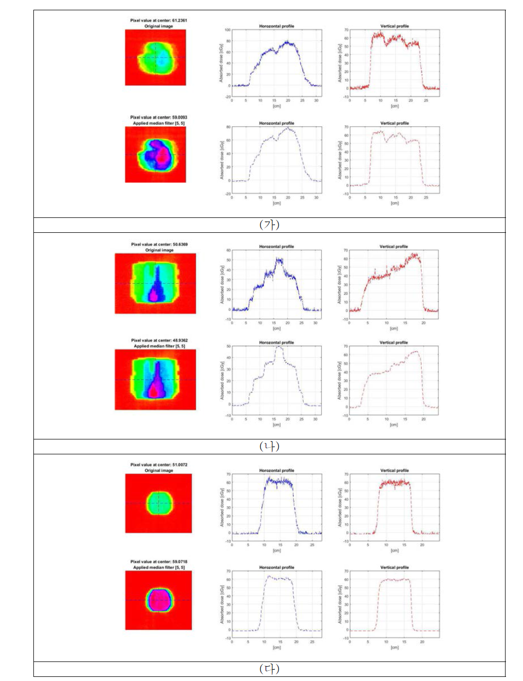 개발된 생체선량측정 시스템을 통해 측정한 임상치료부위에 대한 2차원 선량분포. (가) H&N, (나) Liver, (다) Prostate