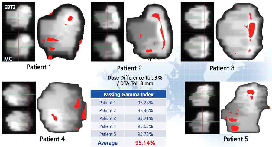 실제 IMRT cases의 감마분석 결과