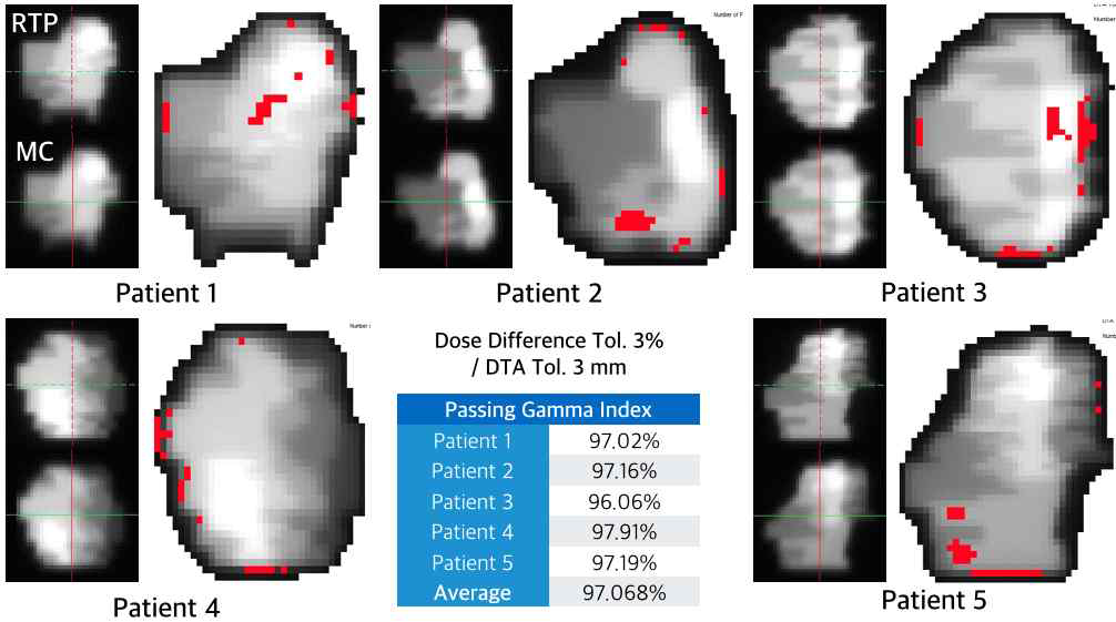 실제 IMRT cases의 RTPS와 MC의 감마분석 결과