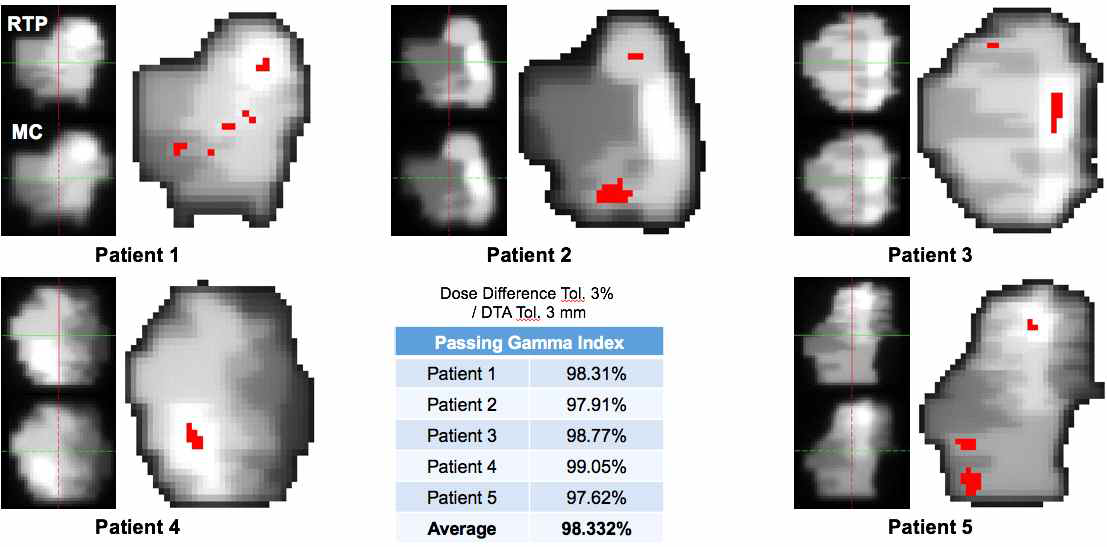 실제 IMRT case의 iPlan과 MC의 감마분석 결과