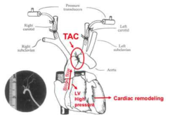 대동맥 협착 수술을 통한 이행단계별 비허혈성 심부전 동물모델 구축