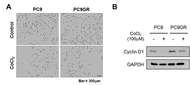 (A) CoCl2를 처리 하지 않은 경우와 처리했을 때에 폐암세포주 에서의 증식 상태를 보여주는 결과 (Incucyte를 이용하여 세포 점유율을 촬영한 대표적인 세포 영상 사진). (B) CoCl2에를 처리 하지 않은 경우와 처리했을 때에 폐암세포주 에서의 cyclin D1 protein 레벨 분석. GAPDH는 loading control로 사용됨