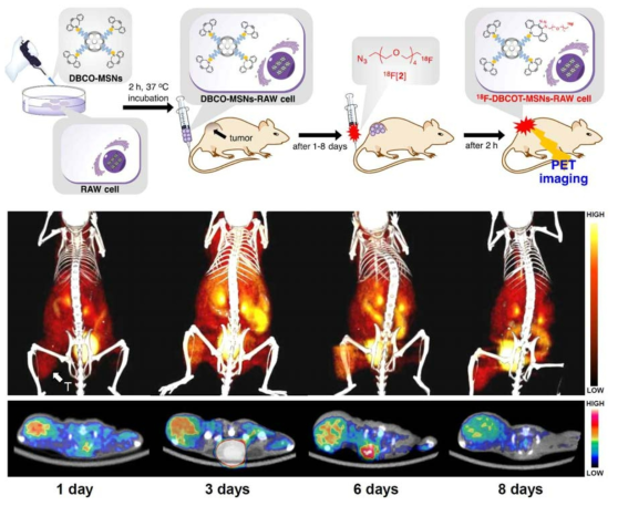 세포 추적 영상. Macrophage cell tracking PET imaging study by the bioorthogonal 18F-labeling. PET-CT images of 18F-labeled azide ([18F]2; 2.6 MBq) in U87 MG tumor-bearing mice given DBCO-MSNs-RAW cells (50 μg of DBCO-MSNs were loaded into the cells) 1, 3, 6, or 8 days earlier (cell tracking study). T = tumor