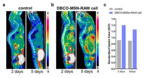 PET images of atherosclerosis by macrophage cell tracking via in vivo F-18 labeling. (a and b) Sagittal PET images of atherosclerosis in ApoE-/-mice on western diet for 30weeks, given only saline (control study; a) or DBCO-MSNs-RAW cells (cell tracking study; b) 2 or 5 days earlier, at 1 h intravenous post-injection of [18F]2, and (c) their standardized uptake values