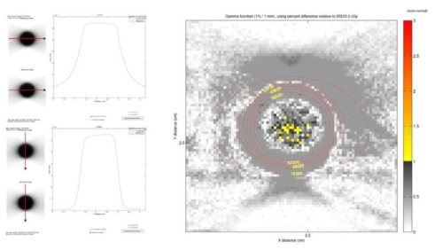 Phase space file을 사용하여 계산한 흡수선량과 Leksell Gamma Plan의 계산값을 비교한 그림. 왼쪽 위는 X축 방향의 1차원적 흡수선량이고, 왼쪽 아래는 Z축 방향 흡수선량이다. 파란선은 LGP, 빨간선은 phase space file로 계산한 결과이다. 오른쪽 그림은 gamma index 값 분포도이다. 노란색 또는 빨간색 부분이 1%/1mm 기준에서 gamma index test를 통과하지 못한 부분이다