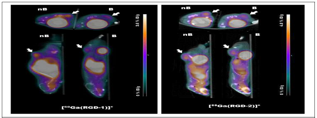 [68Ga]RGD-1을 이용한 U87MG 종양 소동물 PET 영상