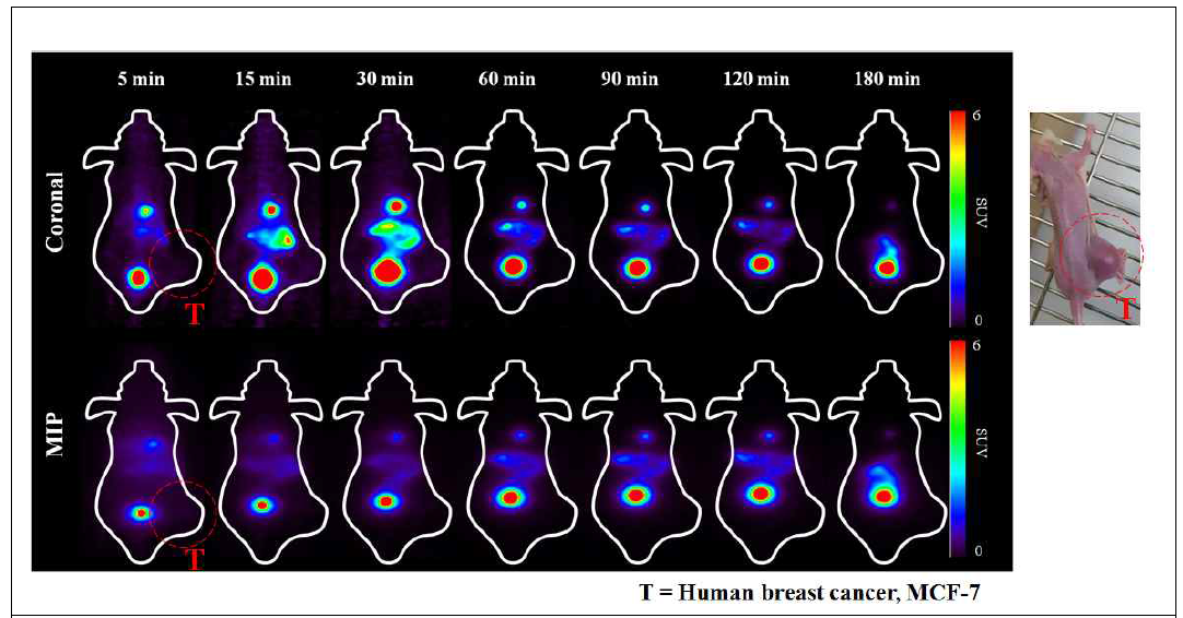 소동물 양전자방출단층촬영 영상 (T = MCF-7 유방암세포주)