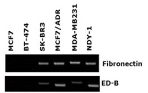 유방암 세포주들에서 표적 리간드인 fibronectin EDB의 발현 RT-PCR 결과