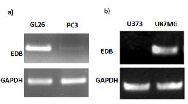 RT-PCR을 이용한 뇌종양 세포 와 전립선암 세포에서 EDB 발현 확인