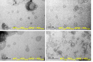 APTEDB-리포좀 나노입자의 TEM 이미지