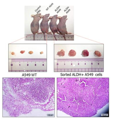 Sorted ALDH+/- A549 in the xenograft model show different phenotype S.C. injection 5x105 cells in Balb/c nude mice(6weeks) ; control PBS, A549 WT, Sorted ALDH+ cells, Sorted ALDH- cells (B) The tumor volume was calculated as follows: V = 0.5 X (the length of width)2 X (the length of length)