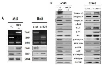 Genetic changes though regulation of FBLN3 gene expression in non-small cell lung cancer cell lines