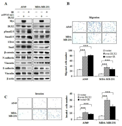 A549세포 및 MDAMB-231세포에서 DLX2 과발현과 감마선조사에 의한 EMT 및 줄기화 마커 단백질 발현 증가 및 이동성/침윤성 증가