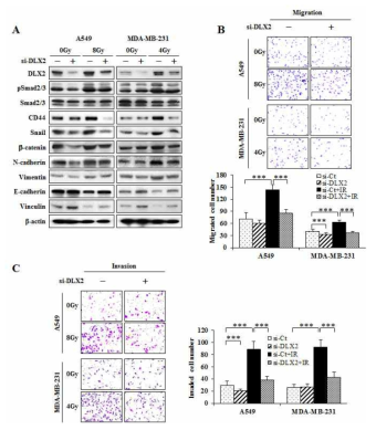 감마선을 조사한 A549세포 및 MDA-MB-231 세포에서 DLX2 발현억제에 의한 EMT, 줄기화 및 이동성/침윤성 감소 효과