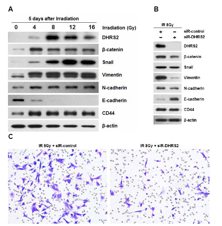 DHRS2 발현 억제에 의한 감마선 조사 A549 세포의 EMT 및 이동성 억제 효과. (A) 감마선조사에 의한 DHRS2 발현증가 및 EMT 마커 증가 (B) DHRS2 및 EMT 관련 유전자의 단백질 발현양 분석 결과 (C) Transwell을 이용한 세포의 이동성 분석 결과
