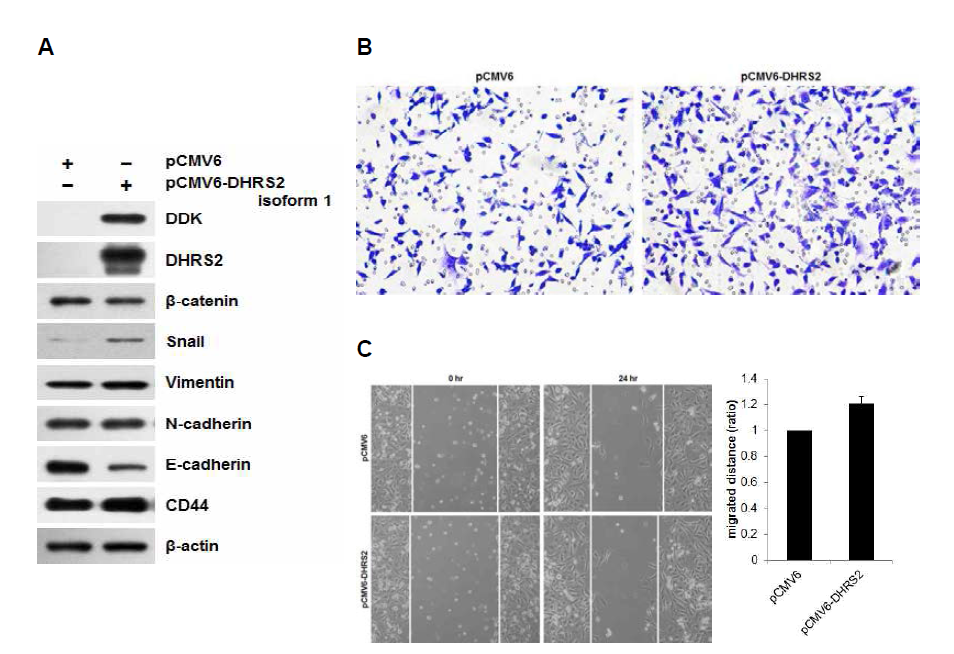 DHRS2 과발현에 의한 EMT 및 줄기화 관련 단백질 발현 변화 및 세포 이동성 증가 효과. (A) Western blot, (B) Transwell assay, (C) Wound healing assay