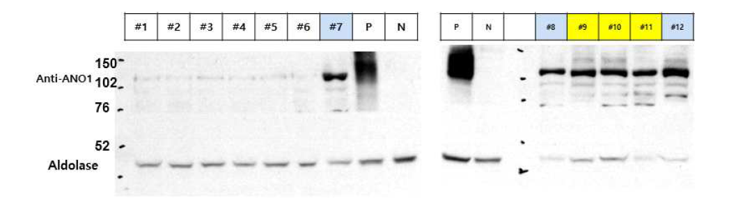 TMEM16A/ANO1 stable cell in PANC1