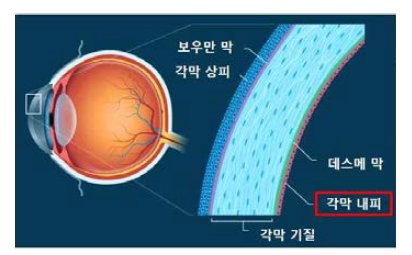 각막의 해부학적 구조(좌) (http://www.allaboutvision.com/resource s/cornea.htm의 그림을 수정)