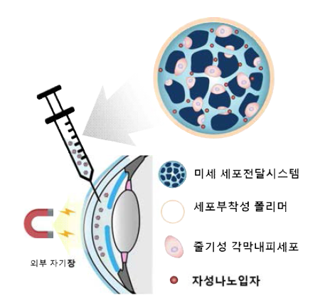 자성나노입자가 탑재된 다공성 PLGA microparticular system의 구성 및 각막내피로의 세포 전달 기전을 나타낸 그림