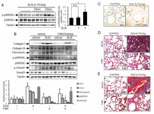 FMK, a specific inhibitor of p90RSK, ameliorates pulmonary fibrosis