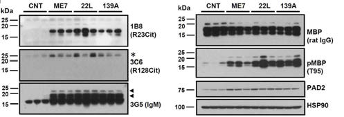 Accumulation of citrullinated MBP in neurodegenerative prion diseases. ME7, 22L and 139A are mouse models of prion diseases