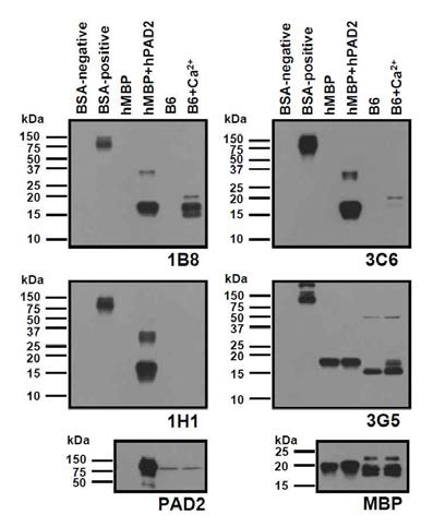 Detection of citrullinated MBP by mouse anti-citrullinated MBP antibodies