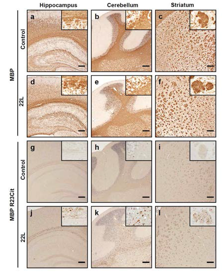 Immunohistochemical staining of citrullinated MBP. Positive staining for citrullinated MBP (dot) were observed in 22L scrapie-infected brain (j-l)