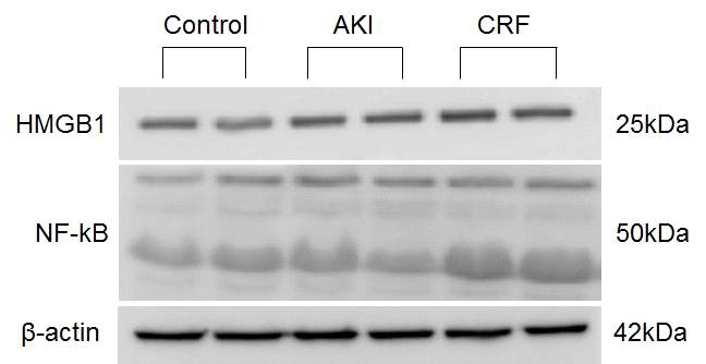 Results of immunoblots and relative optical densities of proteins from brain cortex and hippocampus. Immunoblot analysis against HMGB1 and NF-κB showed specific bands corresponding approximately to 25 and 50kD, respectively. Significantly increased expressions of both HMGB1 and NF-κB were noted in CRF comparing with that of AKI and controlCRF