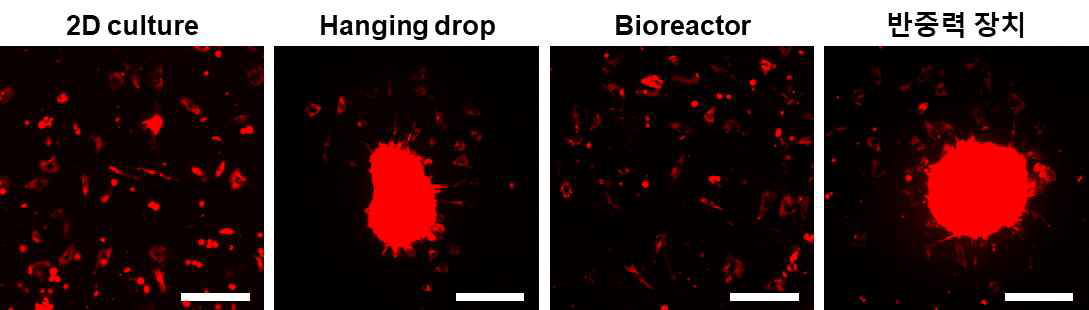 DiI staining을 이용한 hypoxia 환경에 36시간 노출 후 세포 및 응집체 비교 (scale bar=300um)