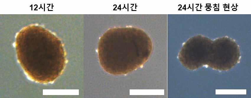 배양 시간에 따른 무중력 삼차원 배양기에서 형성된 줄기세포 기반 삼차원 응집체 (scale bar=300um)