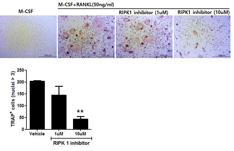 정상 마우스에서 RIP1K inhibitor 처리에 의한 파골세포 분화 억제효과 관찰