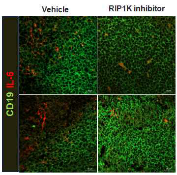 RIP1K inhibitor 처리에 의한 B 세포의 염증성 사이토카인 제어 효과 조사