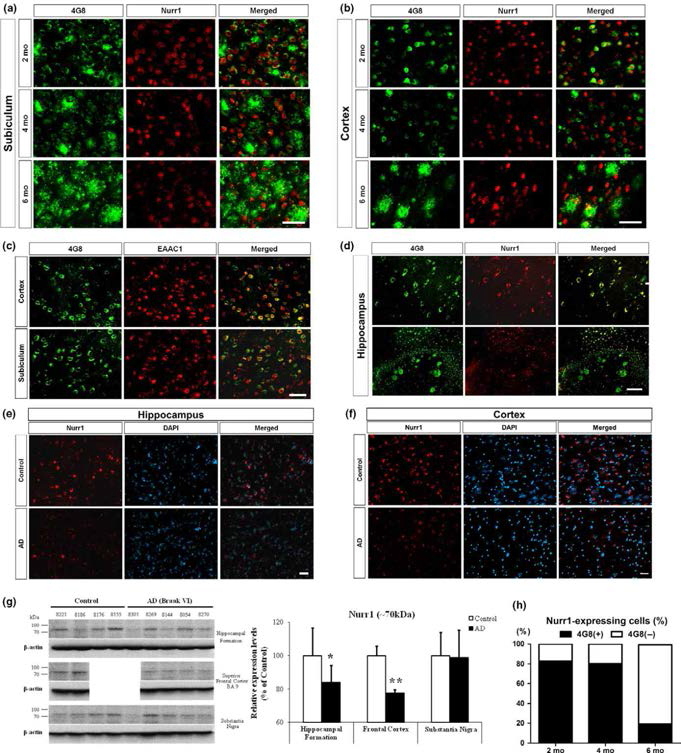 알츠하이머병 환자의 사후 뇌조직과 5XFAD 마우스의 뇌에서 Aβ-축적된 세포의 Nurr1 발현