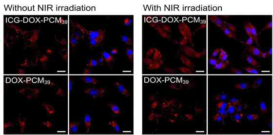 NIR 조사 전/후 항암제의 세포내 분포
