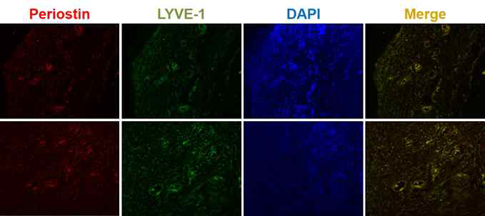 페리오스틴과 LYVE-1 면역형광염색