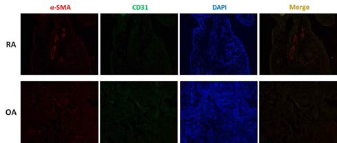 α-SMA와 CD31 면역형광염색