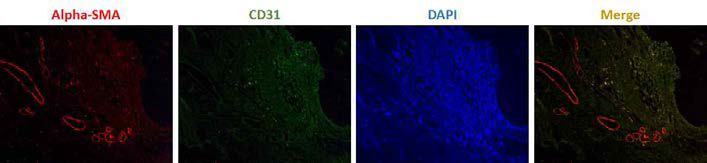 CIA 관절염 모델에서 α-SMA와 CD31 면역형광염색