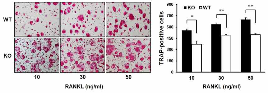 페리오스틴 결손 마우스 골수 유래 단핵구의 파골세포로의 분화 증가